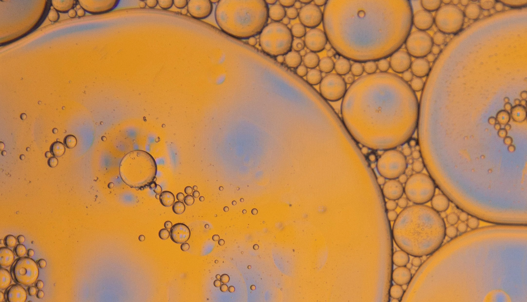 Can Probiotics Protect the Aging Brain?